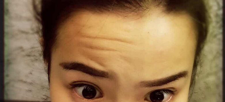 深圳哪幾家醫(yī)美整形醫(yī)院口碑最好？