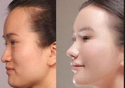 臨沂市醫(yī)美醫(yī)院排名及推薦，推薦你去哪家治療效果好