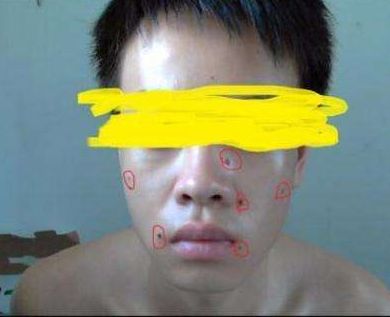 ?？谑笳吾t(yī)院匯總，哪家效果比較好？