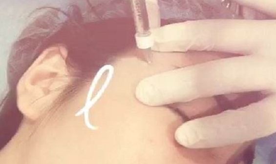 深圳前海地區(qū)哪家整形醫(yī)院比較靠譜？好的深圳整容醫(yī)院有哪些？