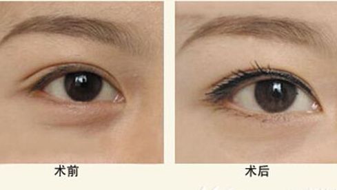 樂山人民醫(yī)院醫(yī)生特色項目與服務評價全解析 樂山人民醫(yī)院醫(yī)生特色項目與服務評價全解析