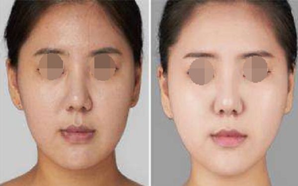 珠海博愛女子醫(yī)院整形外科項目全新推出，項目大揭秘
