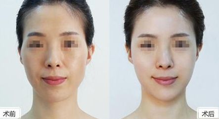 深圳美萊整形醫(yī)院位置介紹，牽手醫(yī)生，搶先體驗(yàn)熱門項(xiàng)目