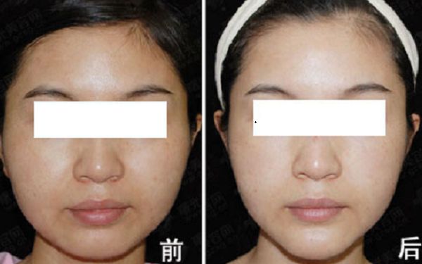 重慶市知名整形美容醫(yī)院榜單出爐！引領(lǐng)時(shí)尚潮流的醫(yī)療機(jī)構(gòu)盤點(diǎn)