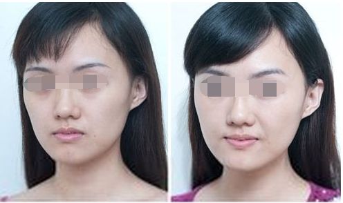 中山整形醫(yī)院八強(qiáng)名單公開！看看這些優(yōu)質(zhì)醫(yī)院是否入選受關(guān)注！