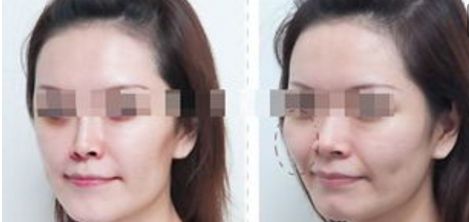 杭州整形美容醫(yī)院排名前六，你值得了解的每一家！