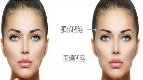 西安妃容醫(yī)療推薦的優(yōu)質美容項目有哪些