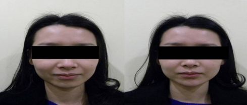 優(yōu)質(zhì)整形醫(yī)院排行榜，找哪家吸脂效果好？