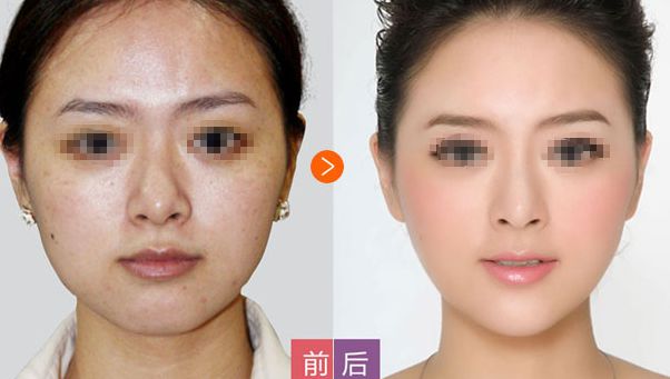 邢臺(tái)博愛高健整容致命嗎？高健整容水平值得信賴！