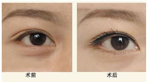 鄭州整形醫(yī)院排名前三，手術(shù)技術(shù)領(lǐng)先無需出差！