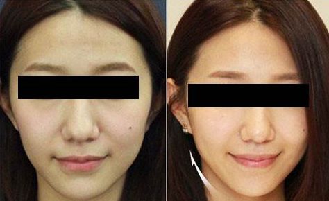 臨沂市哪家整形美容醫(yī)院口碑比較好？