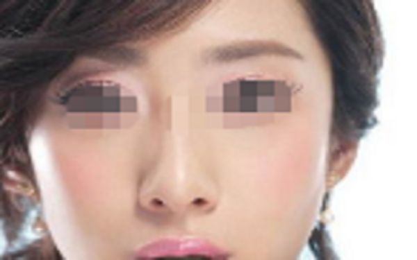 蘇州祛斑整形醫(yī)院哪家好？點(diǎn)擊查看排名前四家醫(yī)院名單！