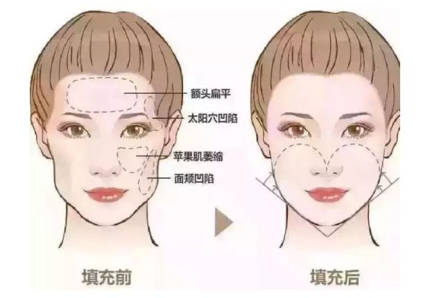 2024年廣州整形醫(yī)院熱門推薦，安全可靠有口碑！