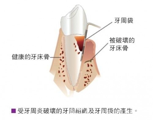 南寧自體細(xì)胞動感豐胸醫(yī)生