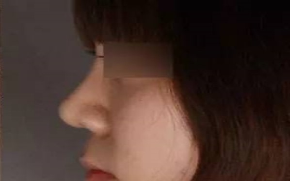 2023濟(jì)寧暢銷整形醫(yī)院匯總：抽脂技術(shù)亮眼，讓你輕松擁有完美身材！