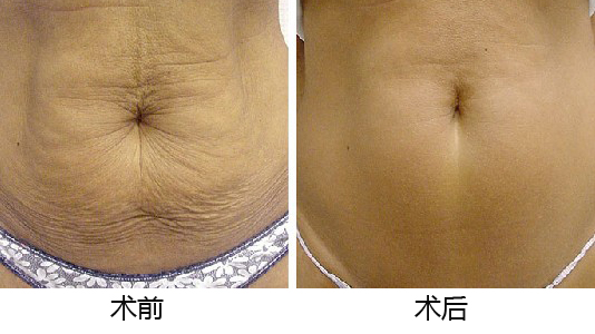 義烏整形醫(yī)院優(yōu)選TOP5，專業(yè)權(quán)威推薦，如何做出準(zhǔn)確選擇？深入了解為上策