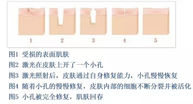 樂(lè)山整形美容院推薦！想在樂(lè)山做整形的話，這些建議不容錯(cuò)過(guò)！