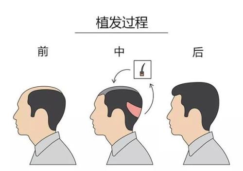 【獨家】年度最佳整形醫(yī)院盤點！2023連續(xù)六年蟬聯冠軍，匠心品質贏得無數口碑推薦！