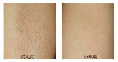 專業(yè)推薦！新疆頂級(jí)眼袋整形醫(yī)生綜合評(píng)價(jià)排行盤點(diǎn)
