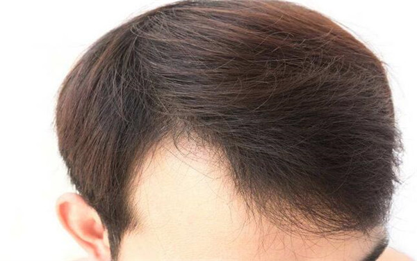 廣州整形醫(yī)院綜合指南：不可錯(cuò)過(guò)的醫(yī)美中心全解析！