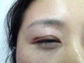廣州隆鼻手術(shù)：挑選最好的醫(yī)生，口碑盤點！是否有你最滿意的專家？