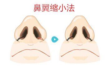 天津疤痕治療醫(yī)院推薦！這5家專業(yè)醫(yī)院排名前列！