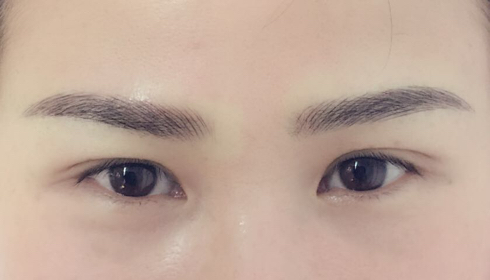 揭秘玉溪整形醫(yī)院匯總：華藝、吳氏嘉美等排行前六，此刻揭開！
