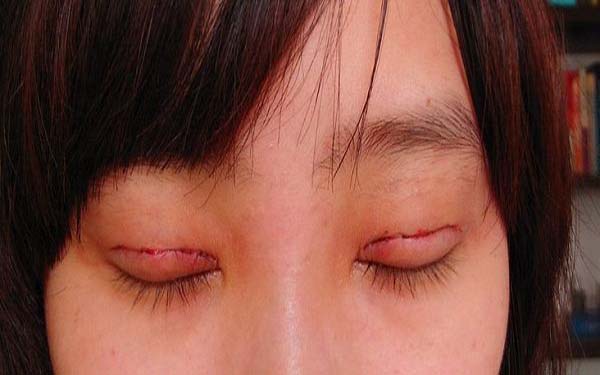 成都整形醫(yī)院修復(fù)隆鼻排行榜：前五強(qiáng)醫(yī)療機(jī)構(gòu)值得推薦！
