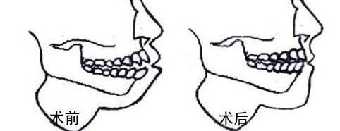 提供重慶哪家私立醫(yī)院割雙眼皮好？前五推薦_軍美領(lǐng)先，再揭秘