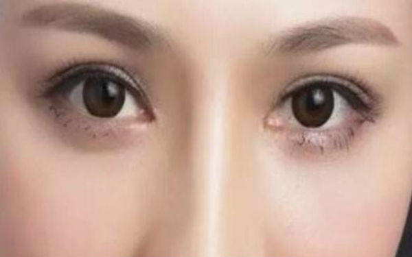 昆明哪家醫(yī)院割雙眼皮技術(shù)獨(dú)特？?jī)H此三家值得信賴(lài)！