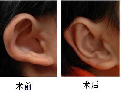 杭州口腔疾病治療首選！濃縮優(yōu)質(zhì)、平價(jià)口腔醫(yī)院一站攻略