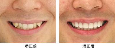 湖南綜合實(shí)力最強(qiáng)的整形醫(yī)院排行榜：這十家業(yè)內(nèi)知名醫(yī)院等你探尋！