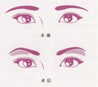 魅力煥發(fā)！常德市多家信譽(yù)醫(yī)院助你邁過疤痕困擾