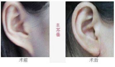2023沈陽(yáng)去魚尾紋雕塑醫(yī)院排行榜，這十家都備受口碑推崇！