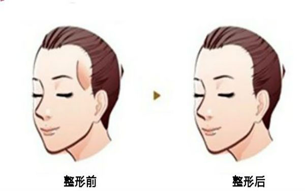 西寧顴骨矯正術(shù)：哪家醫(yī)院口碑好？2023年口碑排名前10的正規(guī)醫(yī)療整形醫(yī)院公布！