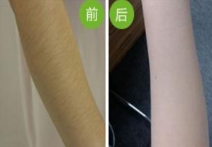 哪家南京雙眼皮手術(shù)醫(yī)院口碑好？2023年南京韓式雙眼皮手術(shù)前十名排序！