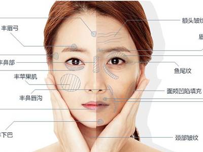 廣州臉部打溶脂針排名前10的美容醫(yī)院口碑大揭秘！2023年很受好評的整形醫(yī)院技術(shù)盤點！