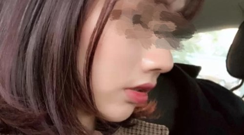 貴陽有哪些專業(yè)的磨皮去痘印醫(yī)院？2023年TOP10推薦實(shí)力醫(yī)院揭曉