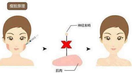 2023武漢隆胸材料取出醫(yī)院排行榜發(fā)布！武漢哪家整形醫(yī)院的推薦度高？