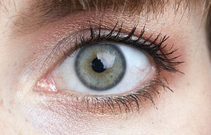 深圳哪個醫(yī)院的顴骨降低整形效果？2023年度排名前十大整形醫(yī)院點評！