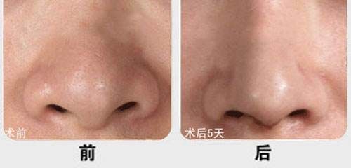漳州有哪些性價比高的雙眼皮微創(chuàng)抽脂醫(yī)院？2023年漳州雙眼皮微創(chuàng)抽脂醫(yī)院排名前十更新！