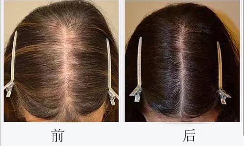 廣州哪些醫(yī)院可靠，專業(yè)進行臉部疤痕切除整形美容？2023年十大排名公開！