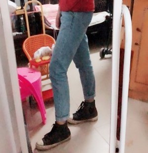胖腿女孩兒福利分享：吸脂瘦大腿的蛻變，效果值得點贊！
