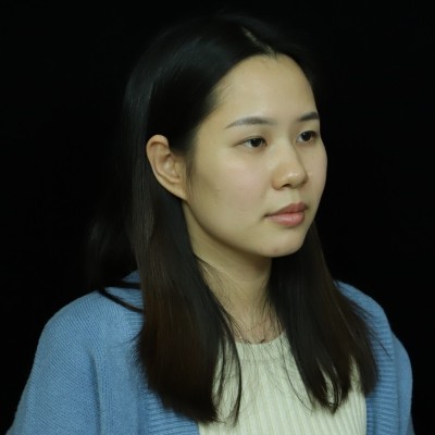 記錄我在廣州韓妃整形美容醫(yī)院眼綜合的手術(shù)經(jīng)歷，還有前后對(duì)比照片~
