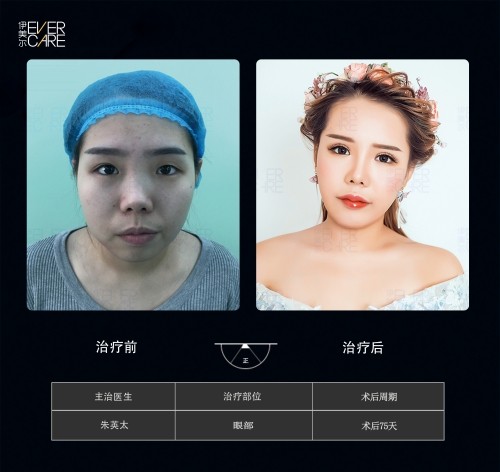 阿爾法9°美眼，打開視界，美無(wú)止境