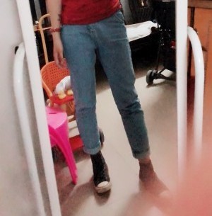 胖腿女孩兒福利分享：吸脂瘦大腿的蛻變，效果值得點贊！