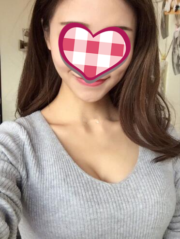 濟南美爾雅整形自體脂肪隆胸術(shù)后兩個月