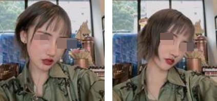 一個鼻子讓一張臉迅速高級，還不考慮做個鼻綜合嗎