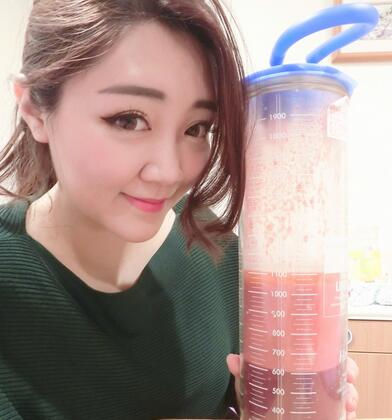 揭陽美萊整形手臂吸脂案例分享，輕松告別拜拜肉