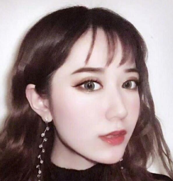 上海藝星整形崔海天下頜角整形術后三個月效果